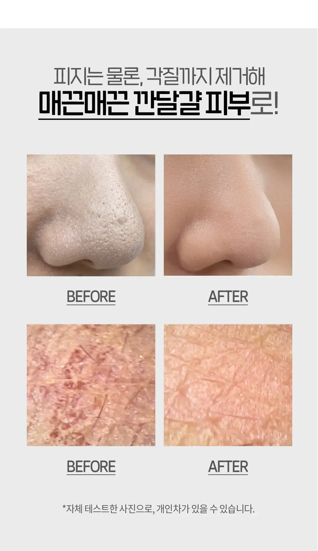 닥터원더 원더 블랙헤드 석션워터 150ml 상세페이지 35