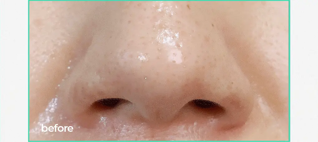 브링그린 티트리 시카 피지 클리닝젤 50ml 기획 (+피지 클리너) 상세페이지 9