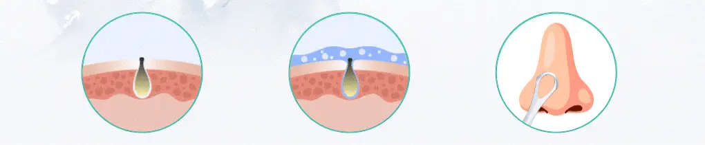 브링그린 티트리 시카 피지 클리닝젤 50ml 기획 (+피지 클리너) 상세페이지 27