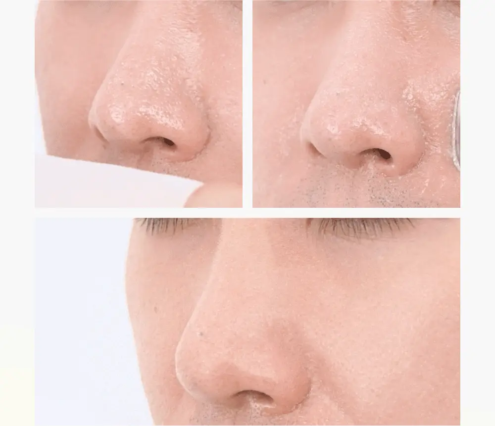 비플레인 녹두 모공 스케일링 워터 150ml 기획 (+초밀착 화장솜 40매) 상세페이지 8