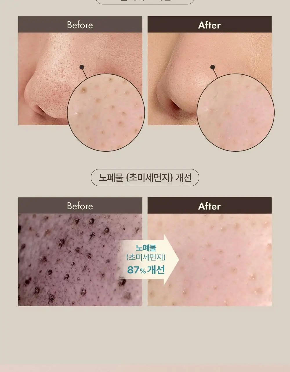 오브제 블랙헤드 스크럽 밤 20g 상세페이지 8
