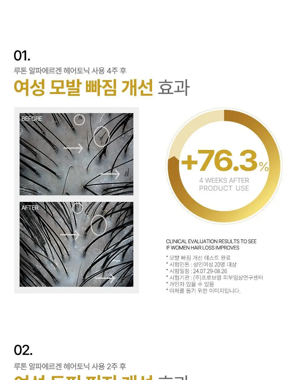 루톤 여성 두피용 알파에르겐 탈모 토닉150ml+샴푸70ml증정기획 상세페이지 7