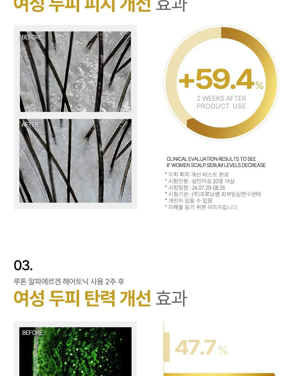 루톤 여성 두피용 알파에르겐 탈모 토닉150ml+샴푸70ml증정기획 상세페이지 8