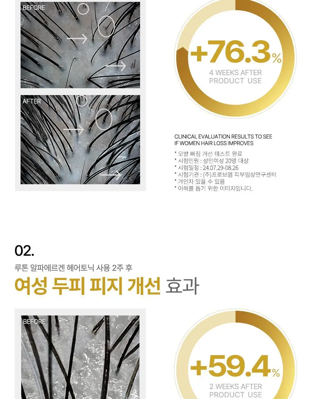 루톤 여성두피용 알파 에르겐 헤어토닉 150ml(탈모증상완화) 상세페이지 6