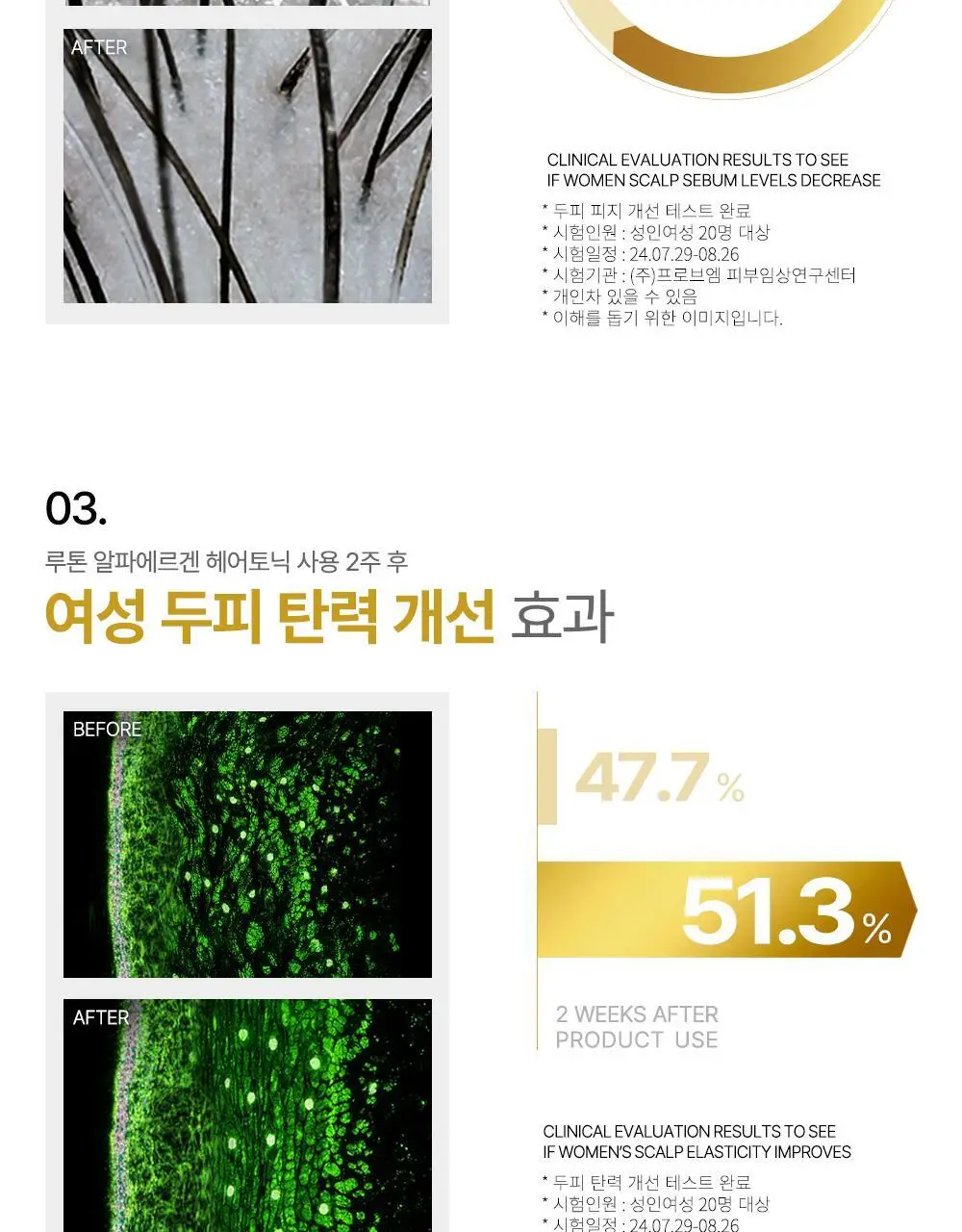 루톤 여성두피용 알파 에르겐 헤어토닉 150ml(탈모증상완화) 상세페이지 7