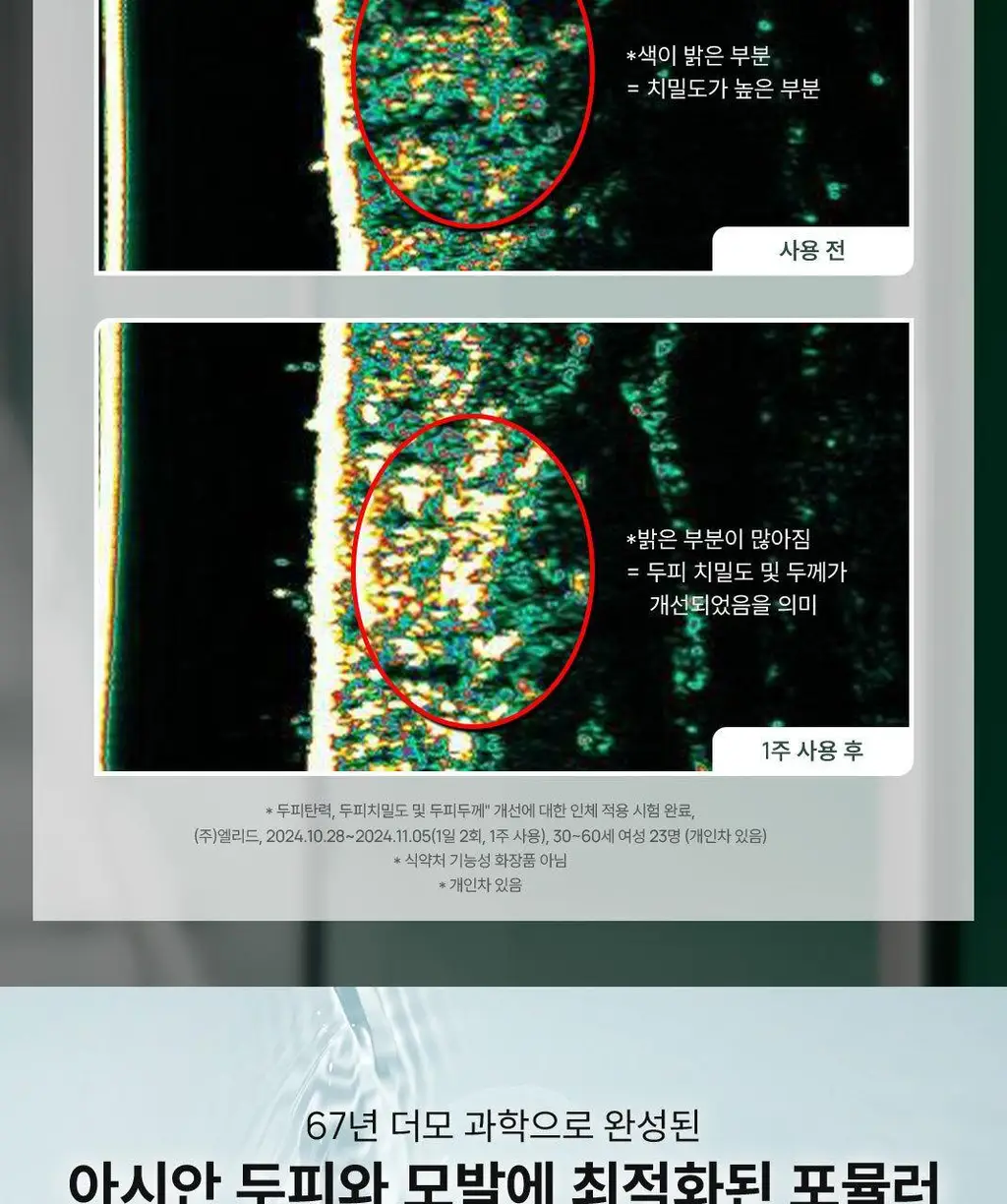 르네휘테르 트리파직 두피 안티에이징 앰플 세럼 100ml 상세페이지 7