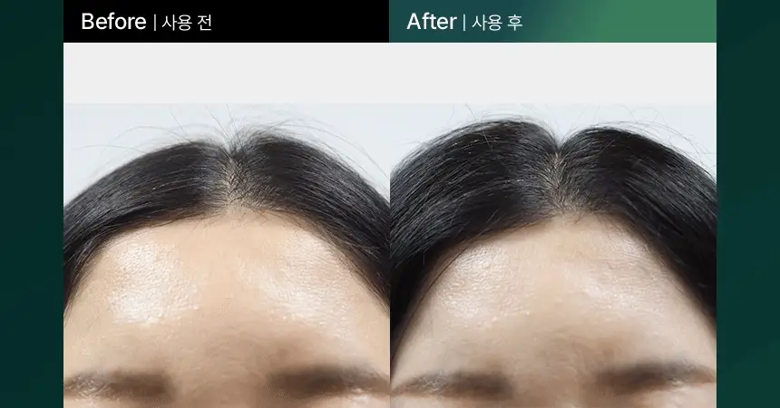 바이브랩 리바이브 테라피 헤어 스칼프 앤 브로우 앰플 상세페이지 15