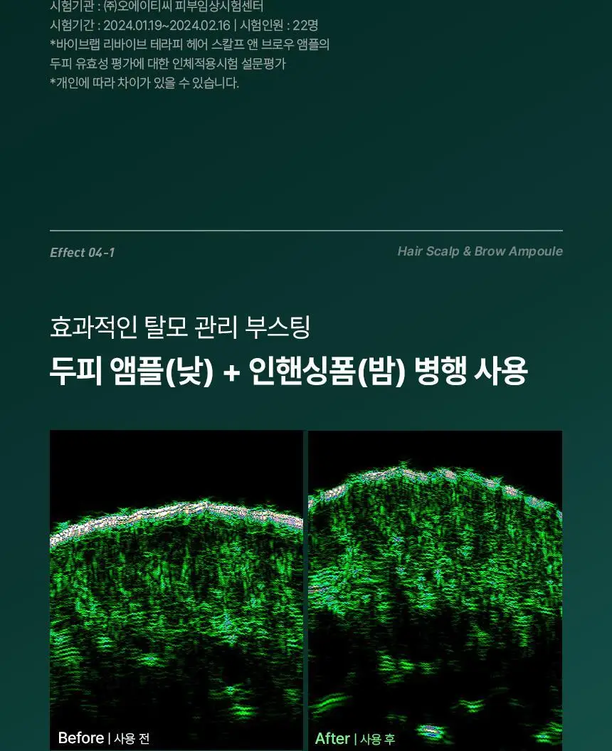 바이브랩 리바이브 테라피 헤어 스칼프 앤 브로우 앰플 상세페이지 23