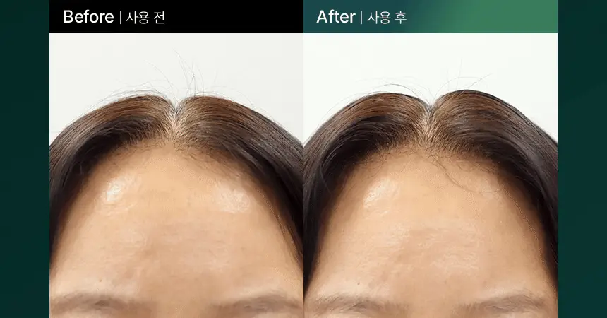 바이브랩 리바이브 테라피 헤어 스칼프 인핸싱 폼 상세페이지 14