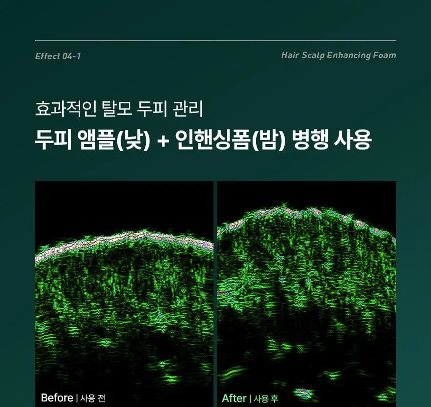 바이브랩 리바이브 헤어 스칼프 인핸싱폼 100ml(단품/기획) 상세페이지 23