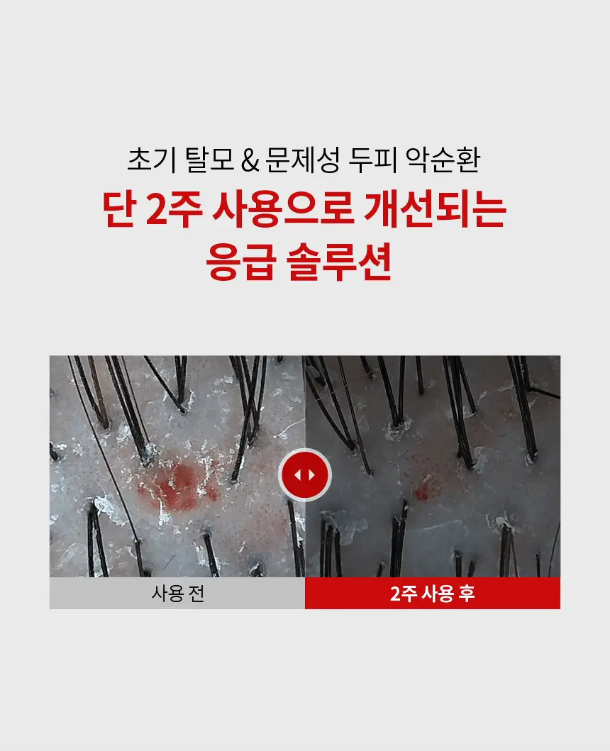 바이브랩 리커버리 클리닉 센서티브 스칼프 SOS 솔루션 에센스 상세페이지 4
