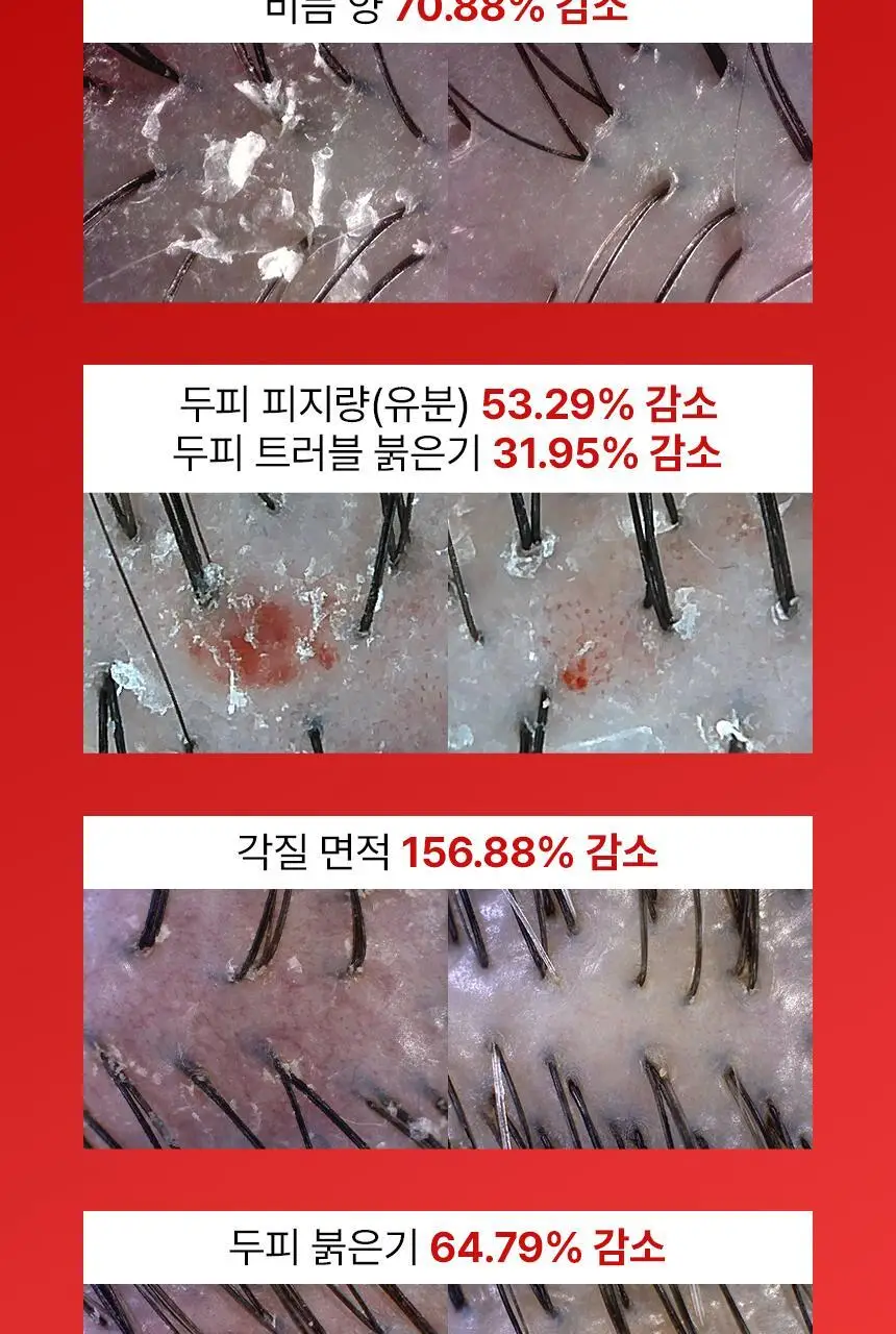 바이브랩 리커버리 클리닉 센서티브 스칼프 SOS 솔루션 에센스 상세페이지 11