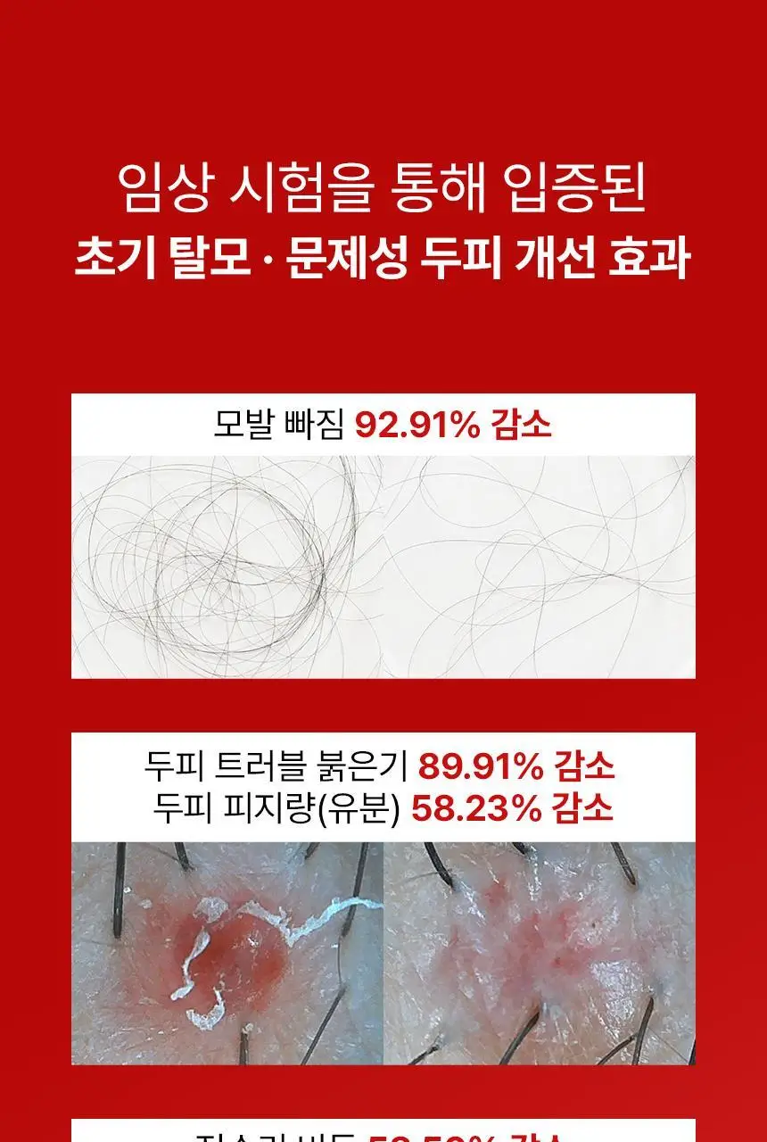 바이브랩 리커버리 클리닉 센서티브 스칼프 SOS 솔루션 헤어 토닉 상세페이지 11