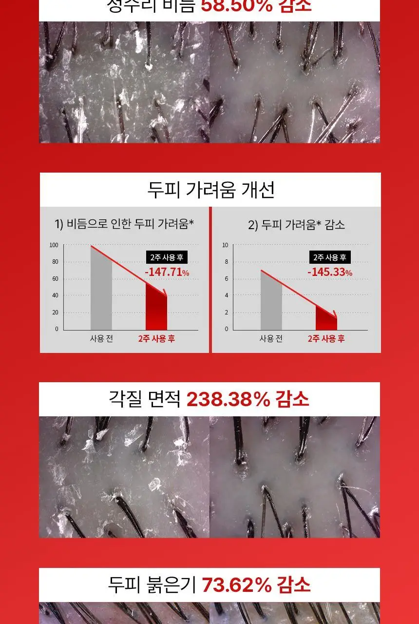 바이브랩 리커버리 클리닉 센서티브 스칼프 SOS 솔루션 헤어 토닉 상세페이지 12
