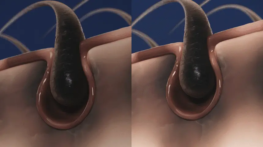 바이브랩 스칼프 스피옥실 리액트 샷 600 15ml 상세페이지 18