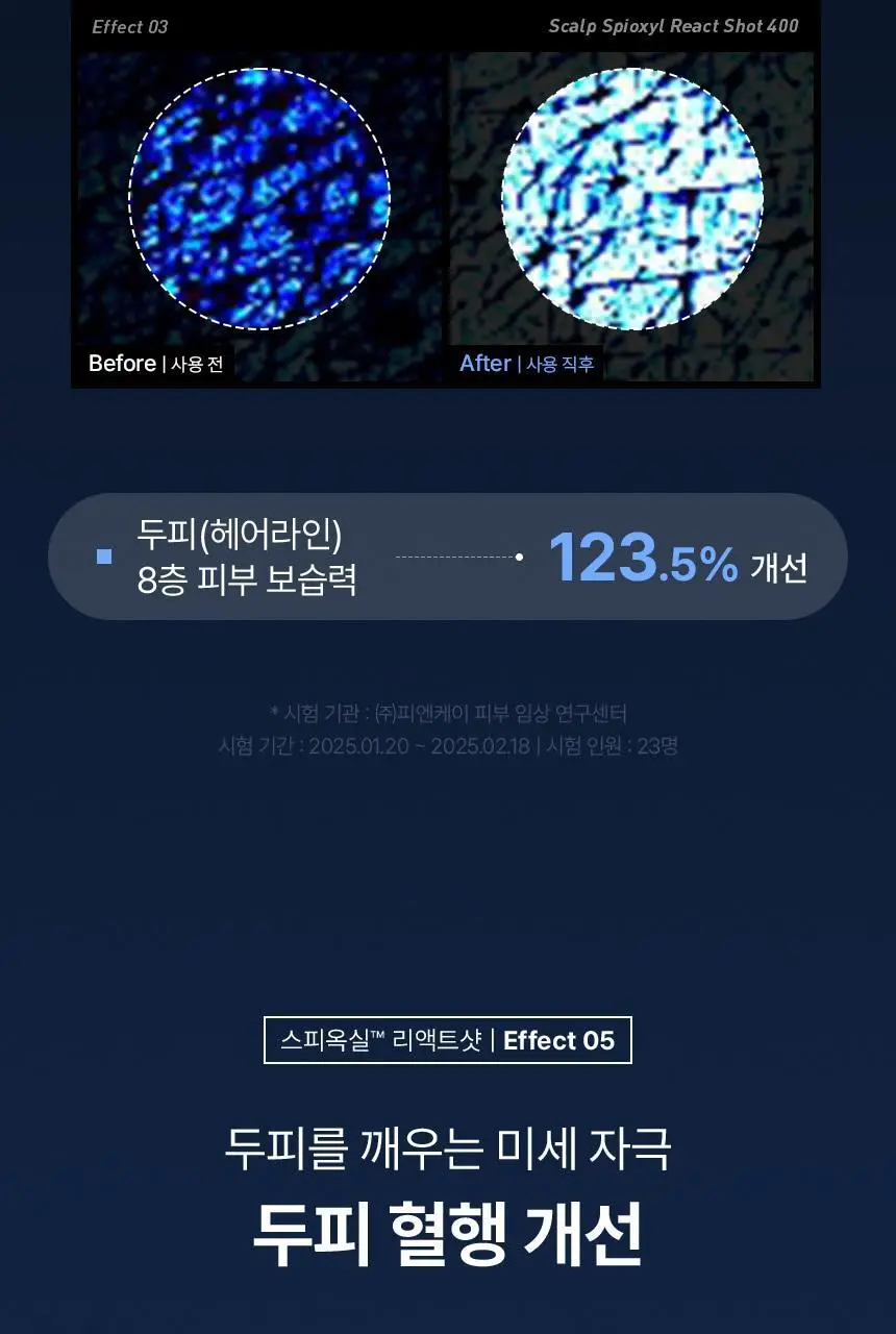 바이브랩 스칼프 스피옥실 리액트샷 400 15ml 상세페이지 24