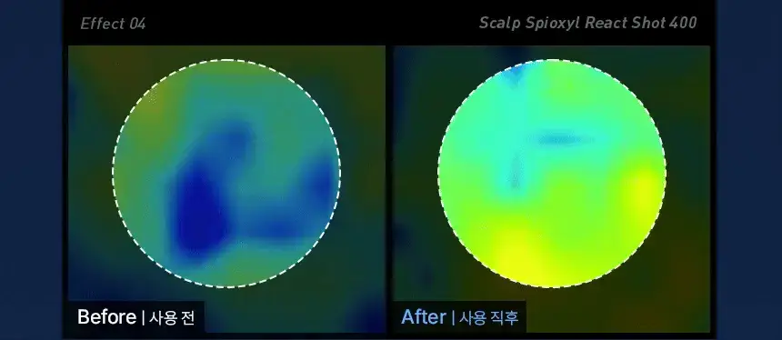 바이브랩 스칼프 스피옥실 리액트샷 400 15ml 상세페이지 26