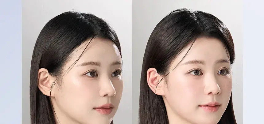 바이브랩 스칼프 스피옥실 리액트샷 400 15ml 상세페이지 29