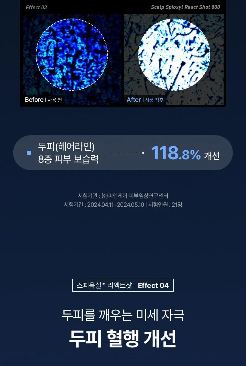 바이브랩 스칼프 스피옥실 리액트샷 800 50ml 상세페이지 14