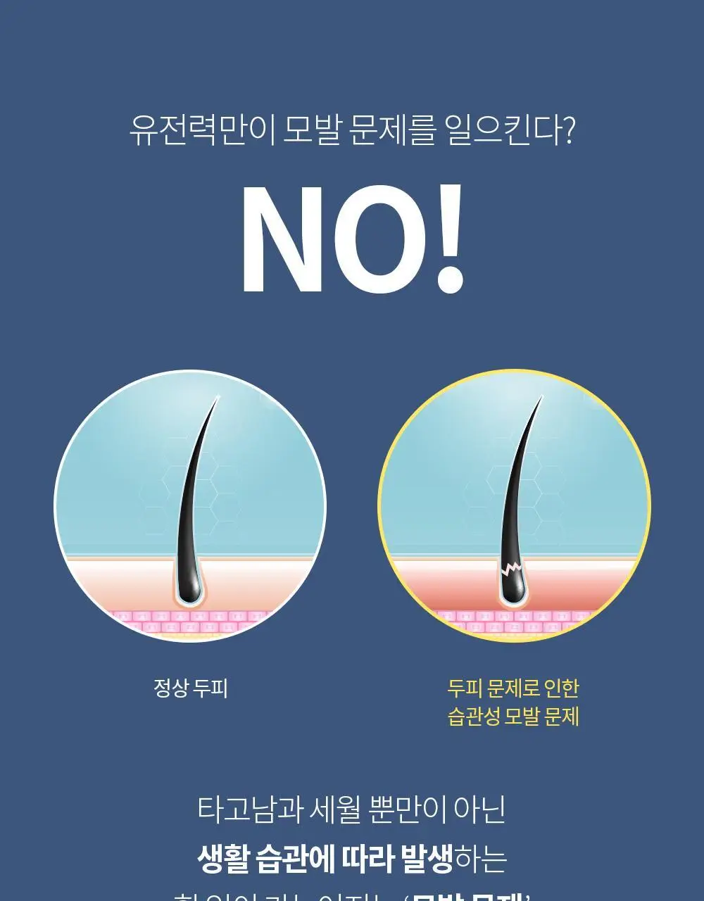 벤튼 어니스트 두피영양제 에센스 토닉 앰플 100ml 상세페이지 7