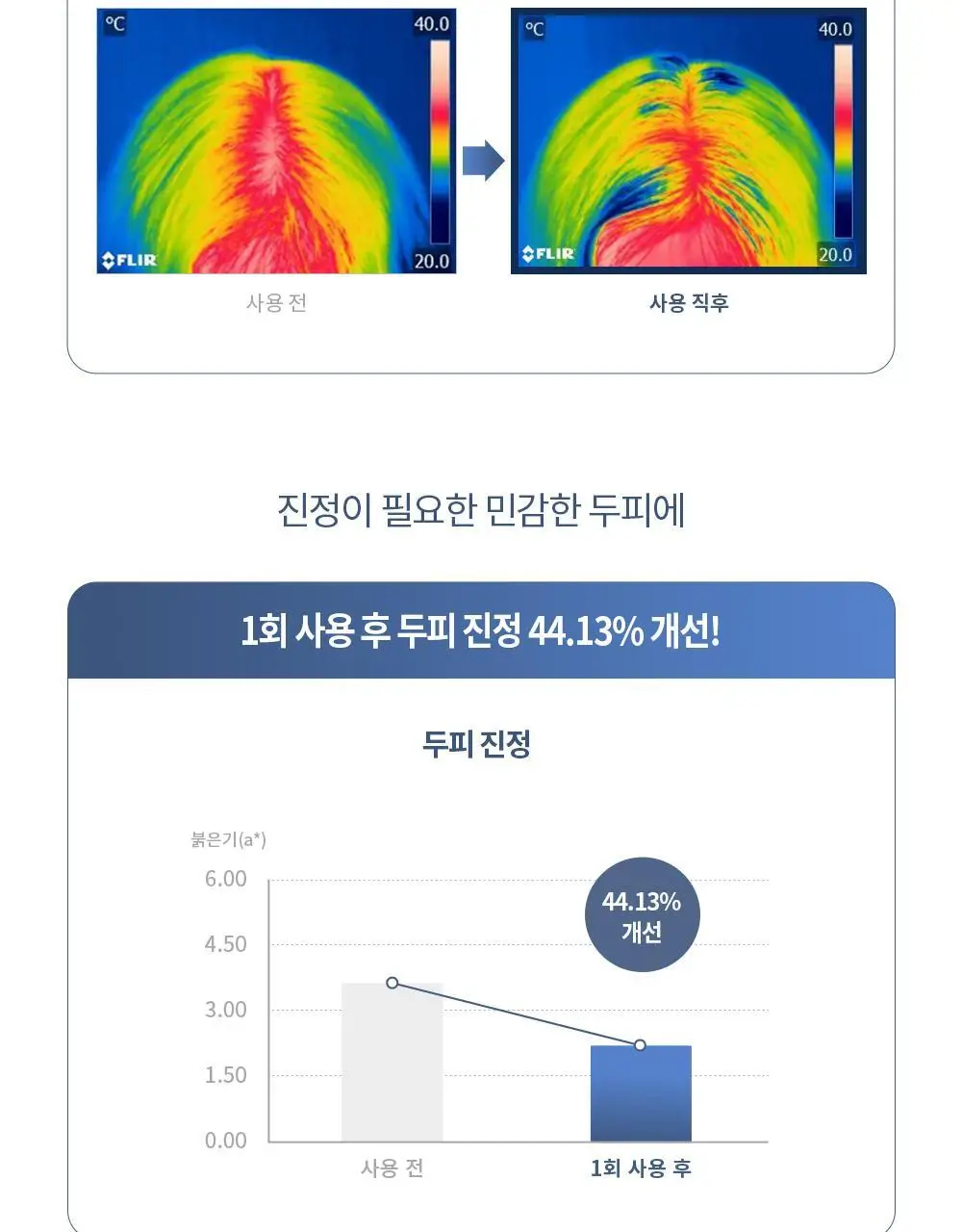 벤튼 어니스트 두피영양제 에센스 토닉 앰플 100ml 상세페이지 34