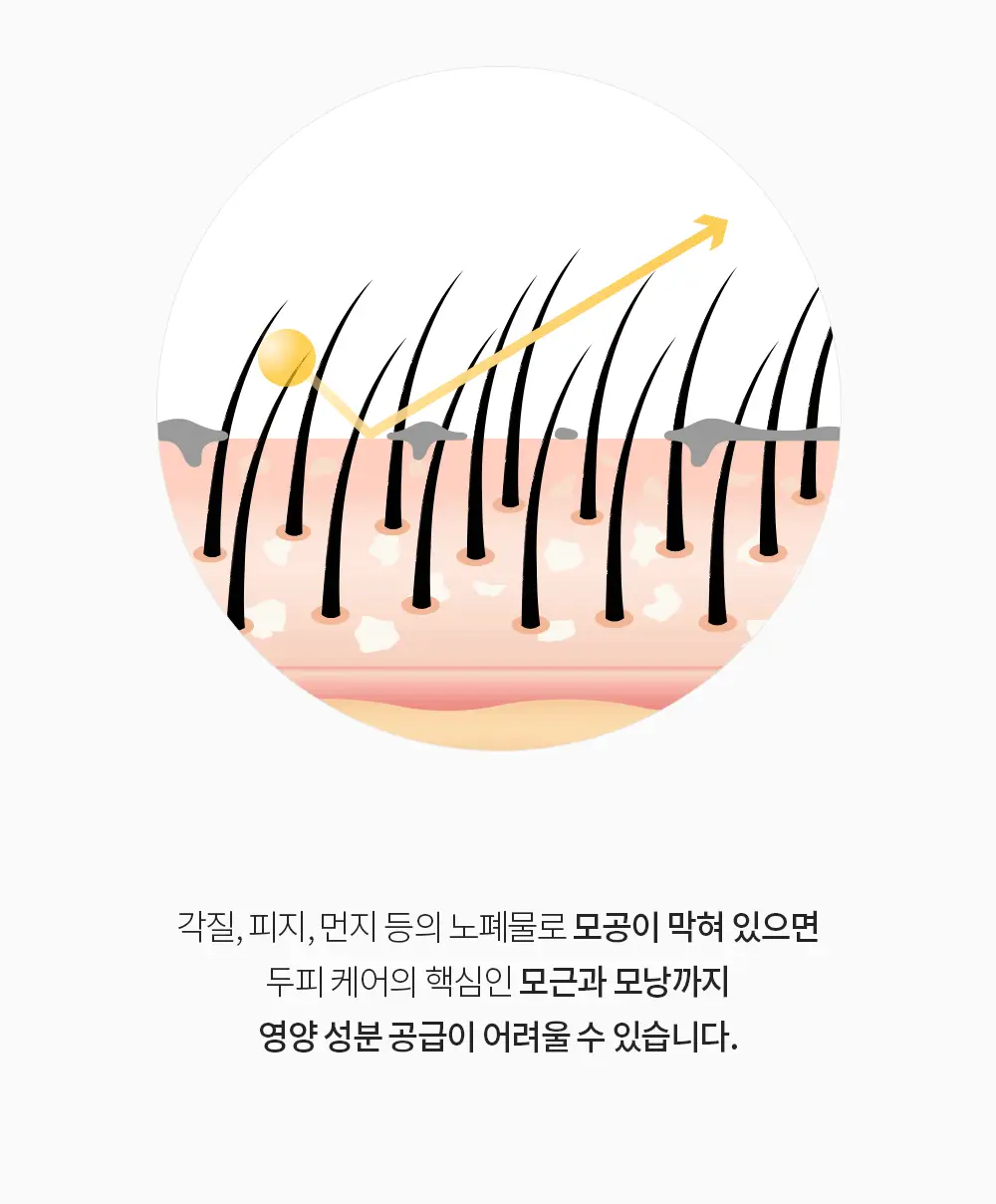 벤튼 어니스트 두피영양제 에센스 토닉 앰플 100ml 상세페이지 38