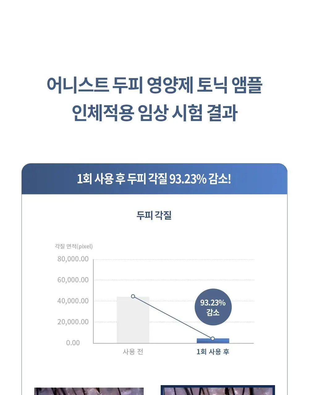 벤튼 어니스트 두피영양제 에센스 토닉 앰플 100ml 상세페이지 42