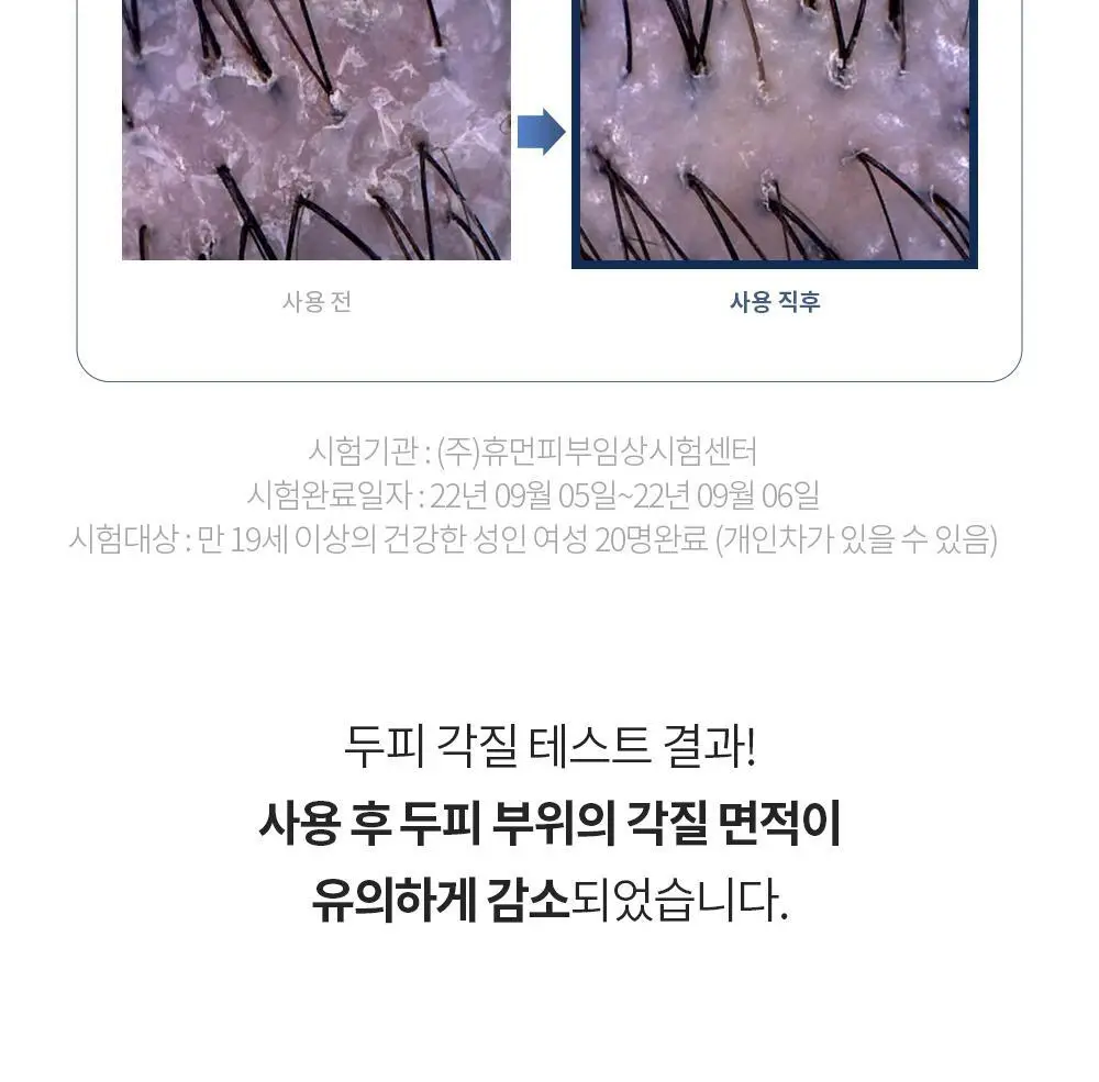 벤튼 어니스트 두피영양제 에센스 토닉 앰플 100ml 상세페이지 43