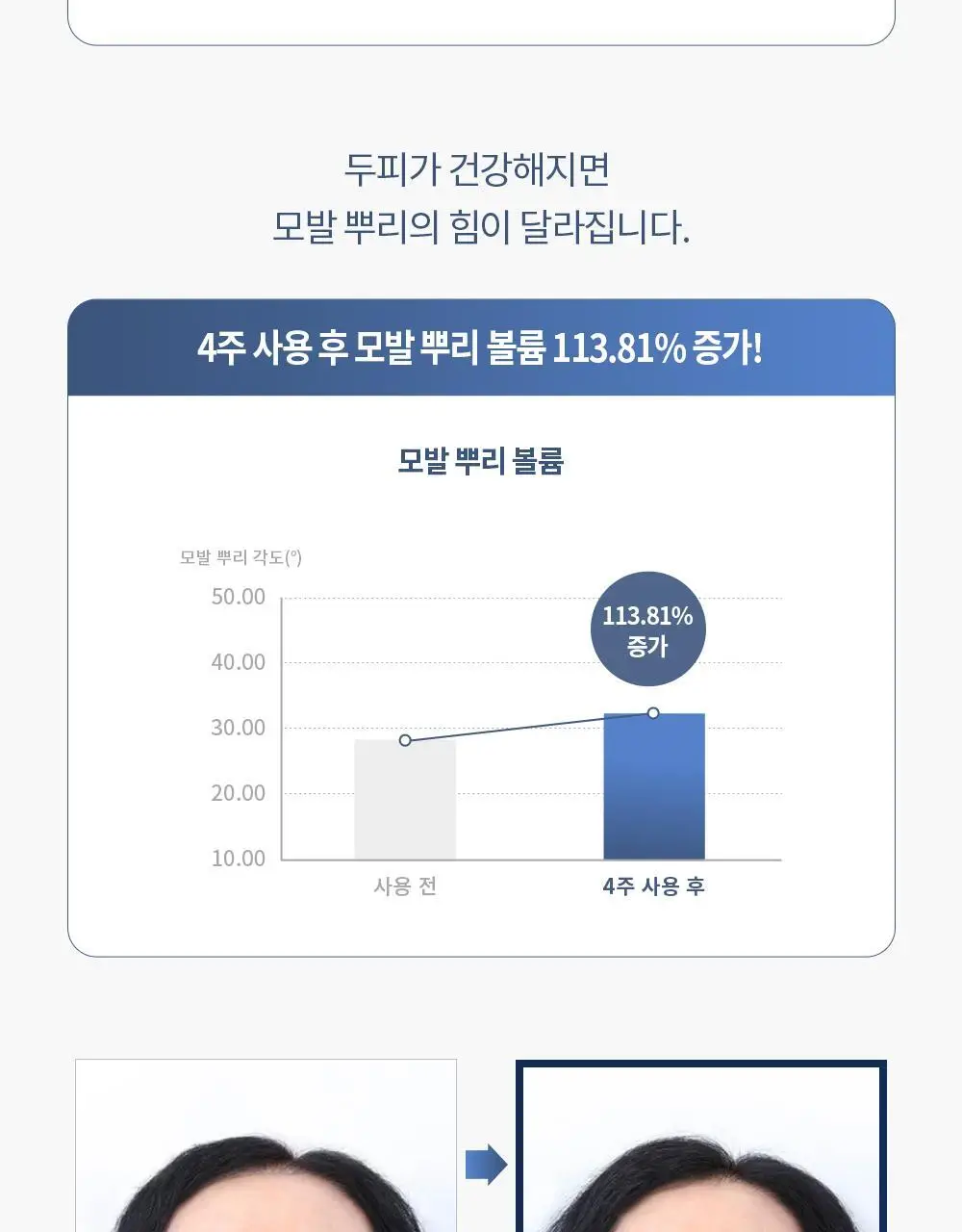 벤튼 어니스트 두피영양제 에센스 토닉 앰플 100ml 상세페이지 55