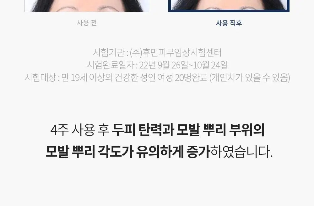 벤튼 어니스트 두피영양제 에센스 토닉 앰플 100ml 상세페이지 56