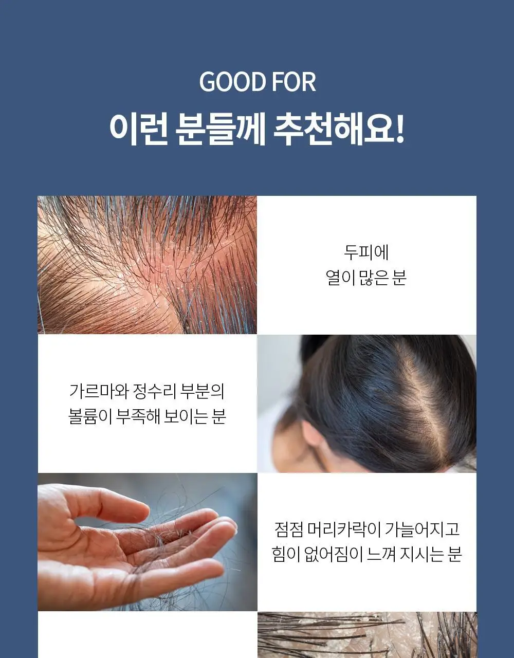 벤튼 어니스트 두피영양제 에센스 토닉 앰플 100ml 상세페이지 70