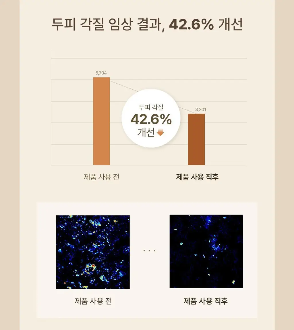 스팀베이스 터메릭 안티 헤어 로스 앰플 15ml 상세페이지 5