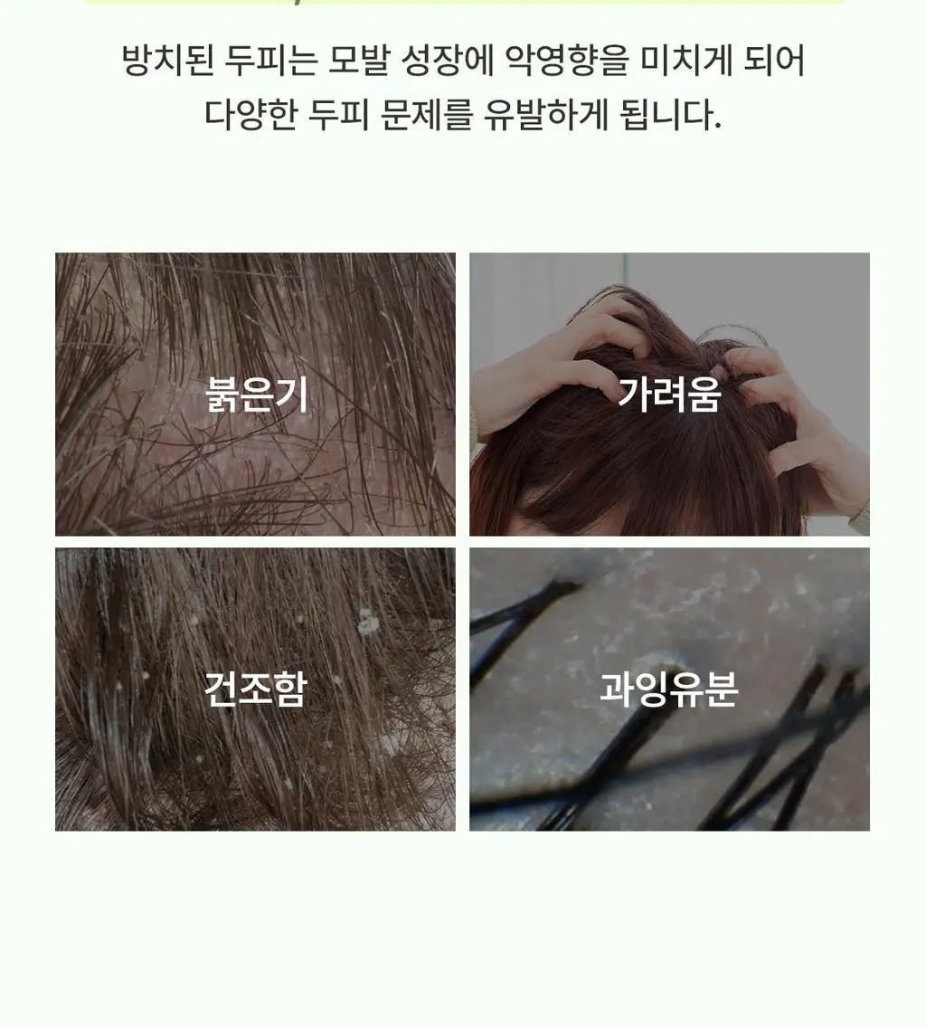 스팀베이스 티트리 스칼프 힐링 토닉 100ml 상세페이지 8