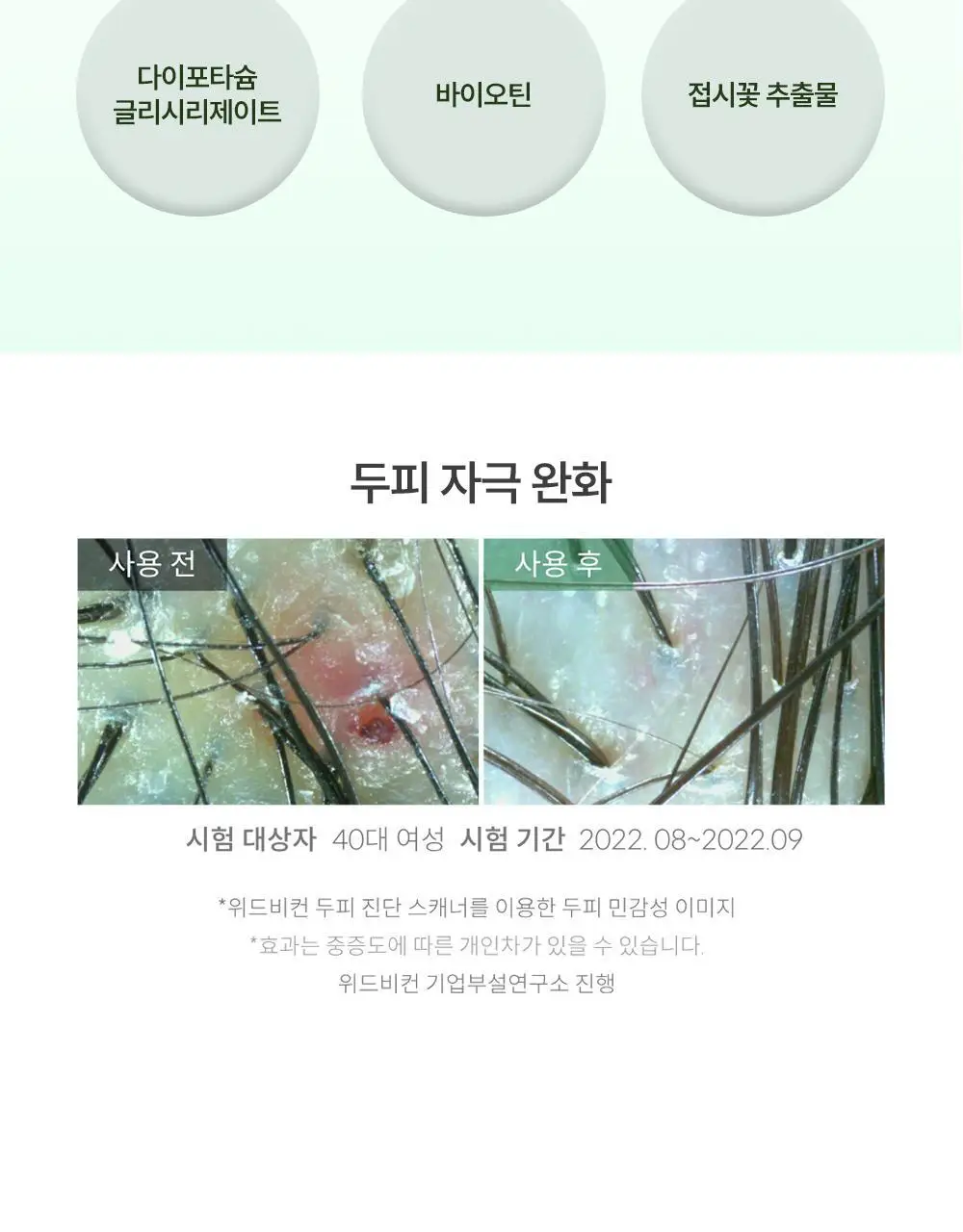 위드비컨 두피 코렉팅 세럼 30ml(탈모증상완화) 상세페이지 19