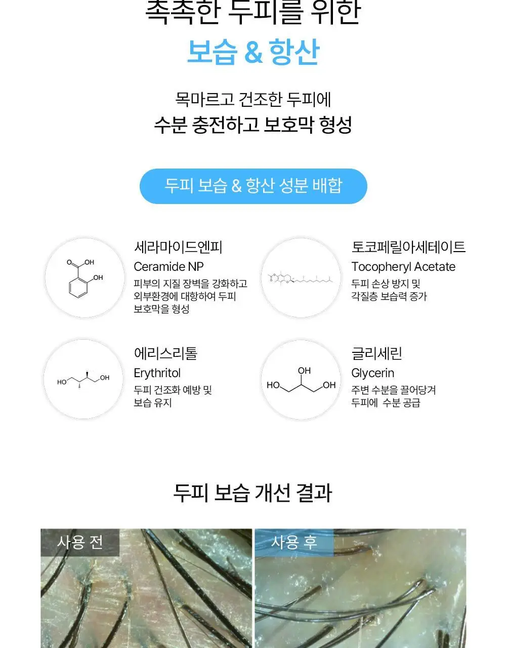 위드비컨 두피 코렉팅 세럼 30ml(탈모증상완화) 상세페이지 27
