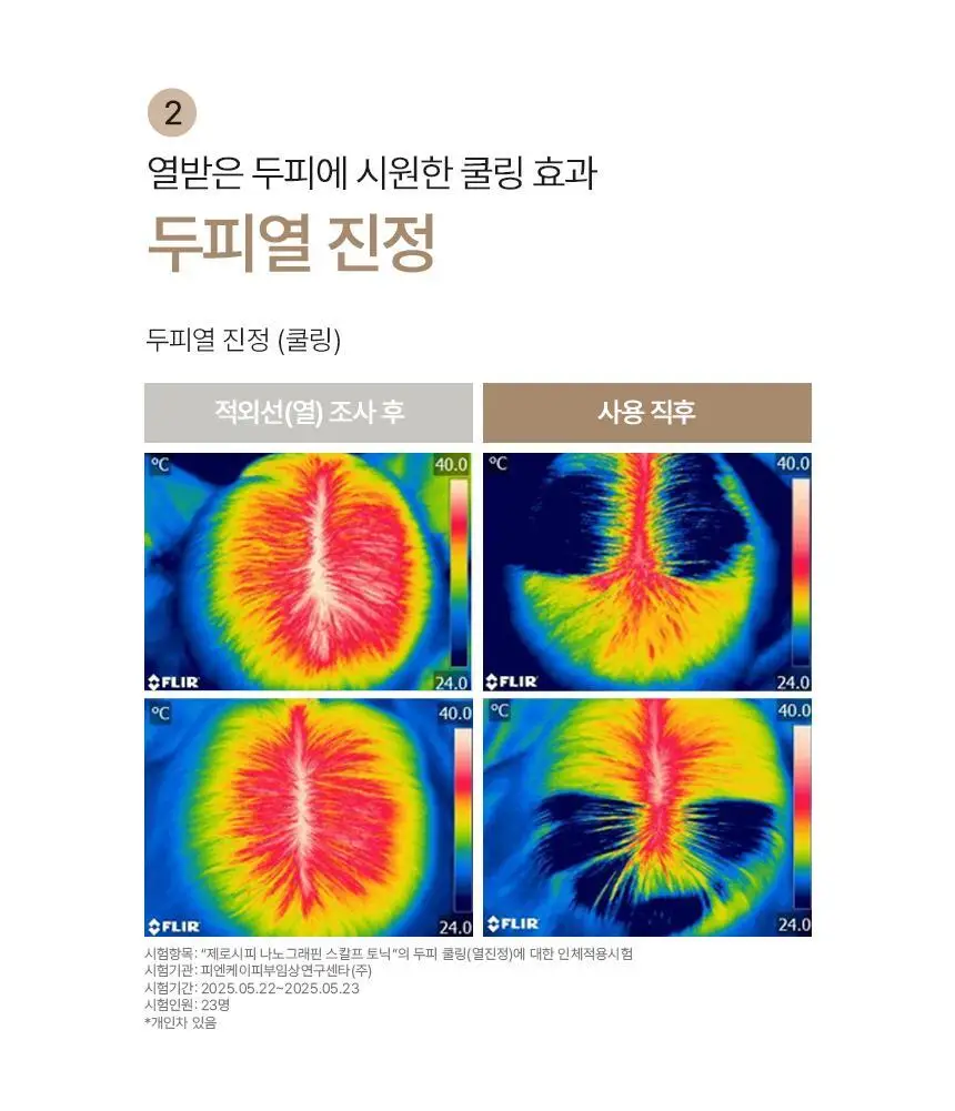 제로시피 나노그래핀 스칼프 토닉 100ml 상세페이지 10