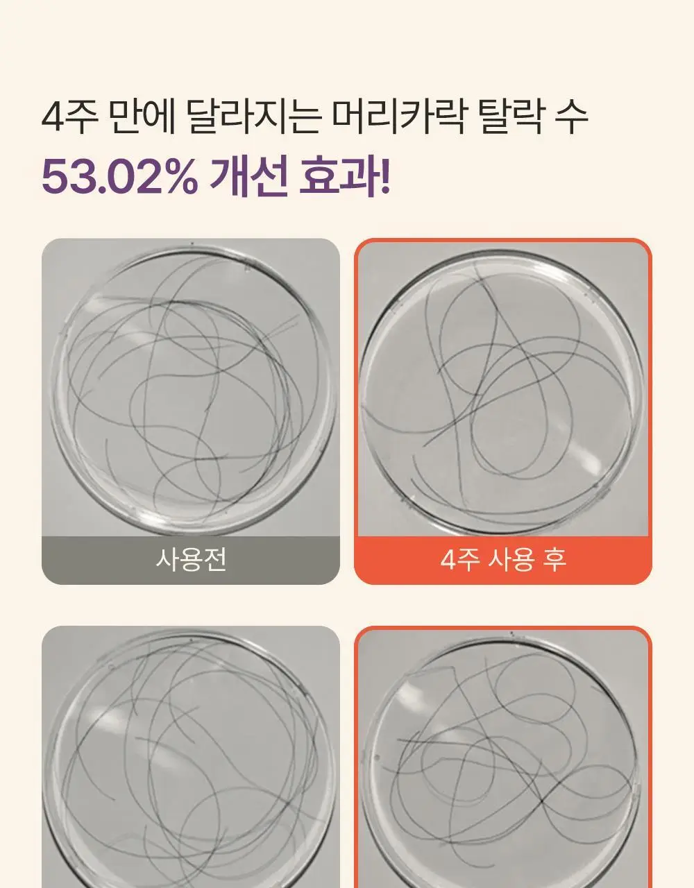 트리코닉스 트리코엑스 두피 앰플 15ml 기획 상세페이지 12