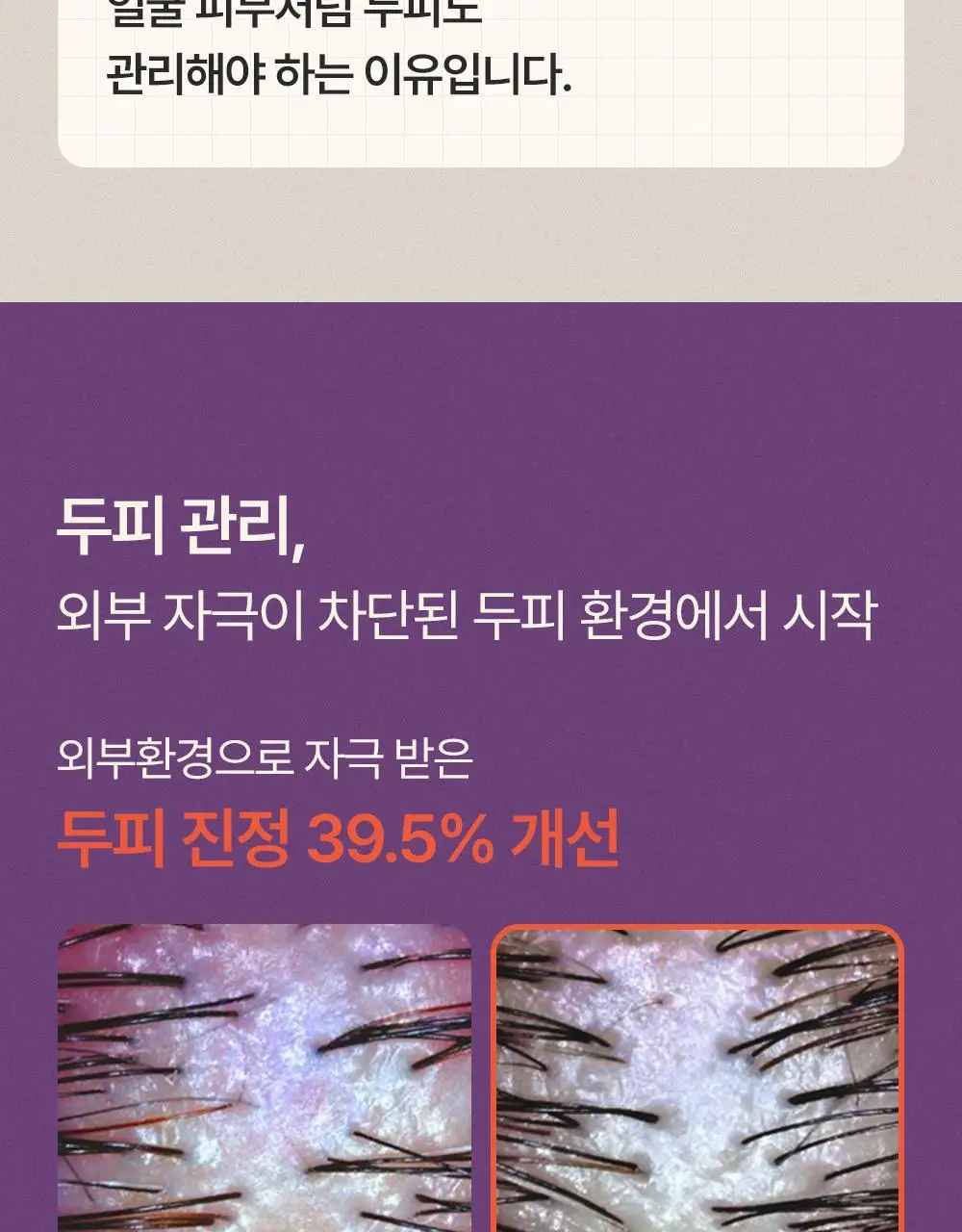 트리코닉스 트리코엑스 두피 앰플 15ml 기획 상세페이지 35