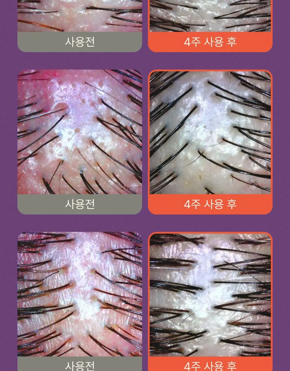 트리코닉스 트리코엑스 두피 앰플 15ml 기획 상세페이지 36
