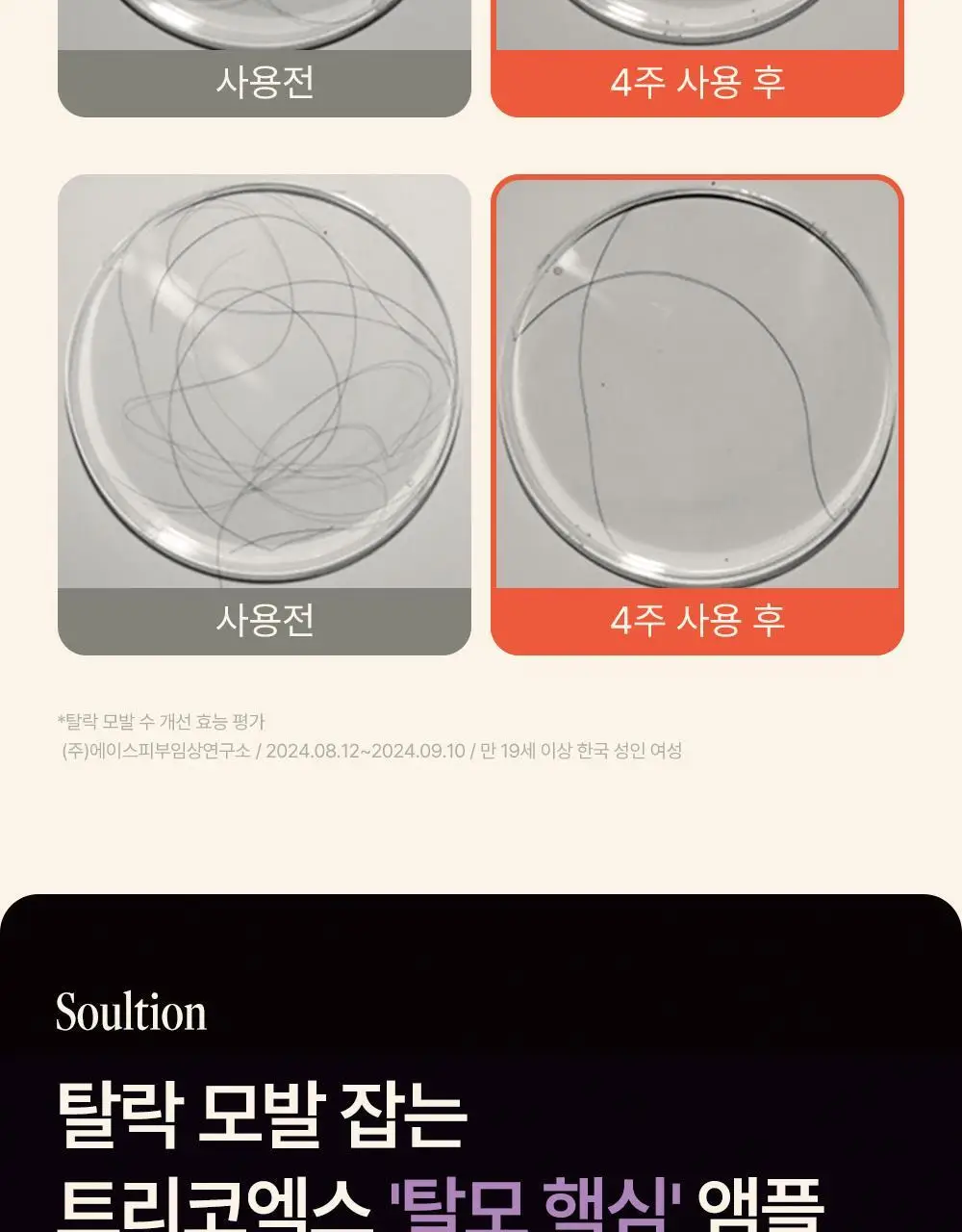트리코닉스 트리코엑스 두피 앰플 30ml 상세페이지 10