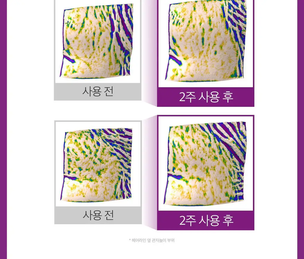 VT 리들샷 헤어 부스팅 앰플 300디엘 15ml 상세페이지 20