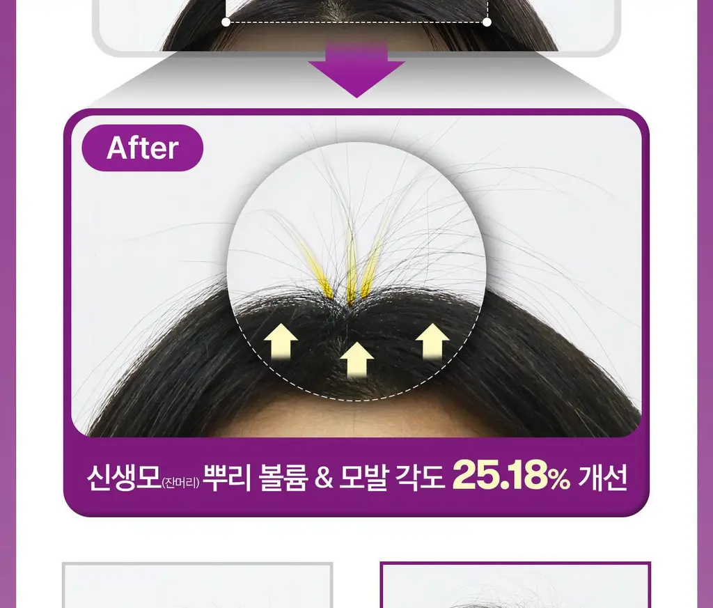 VT 리들샷 헤어 부스팅 앰플 300디엘 15ml 상세페이지 23