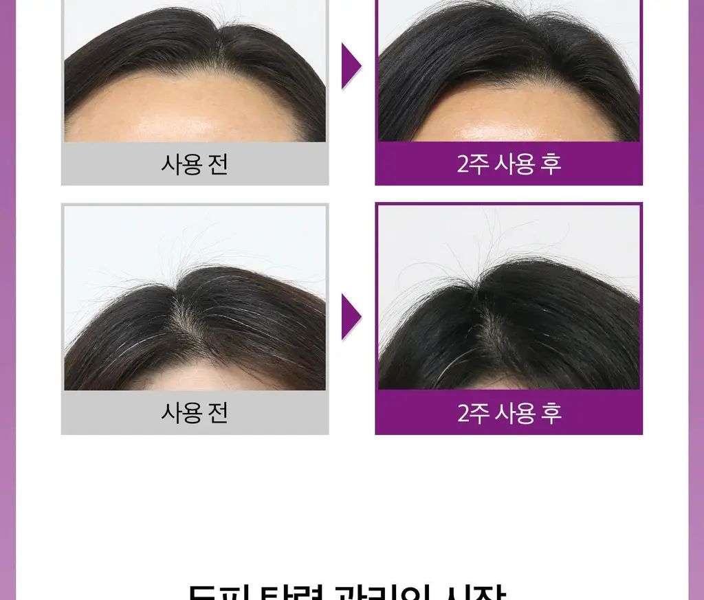 VT 리들샷 헤어 부스팅 앰플 300디엘 15ml 상세페이지 24