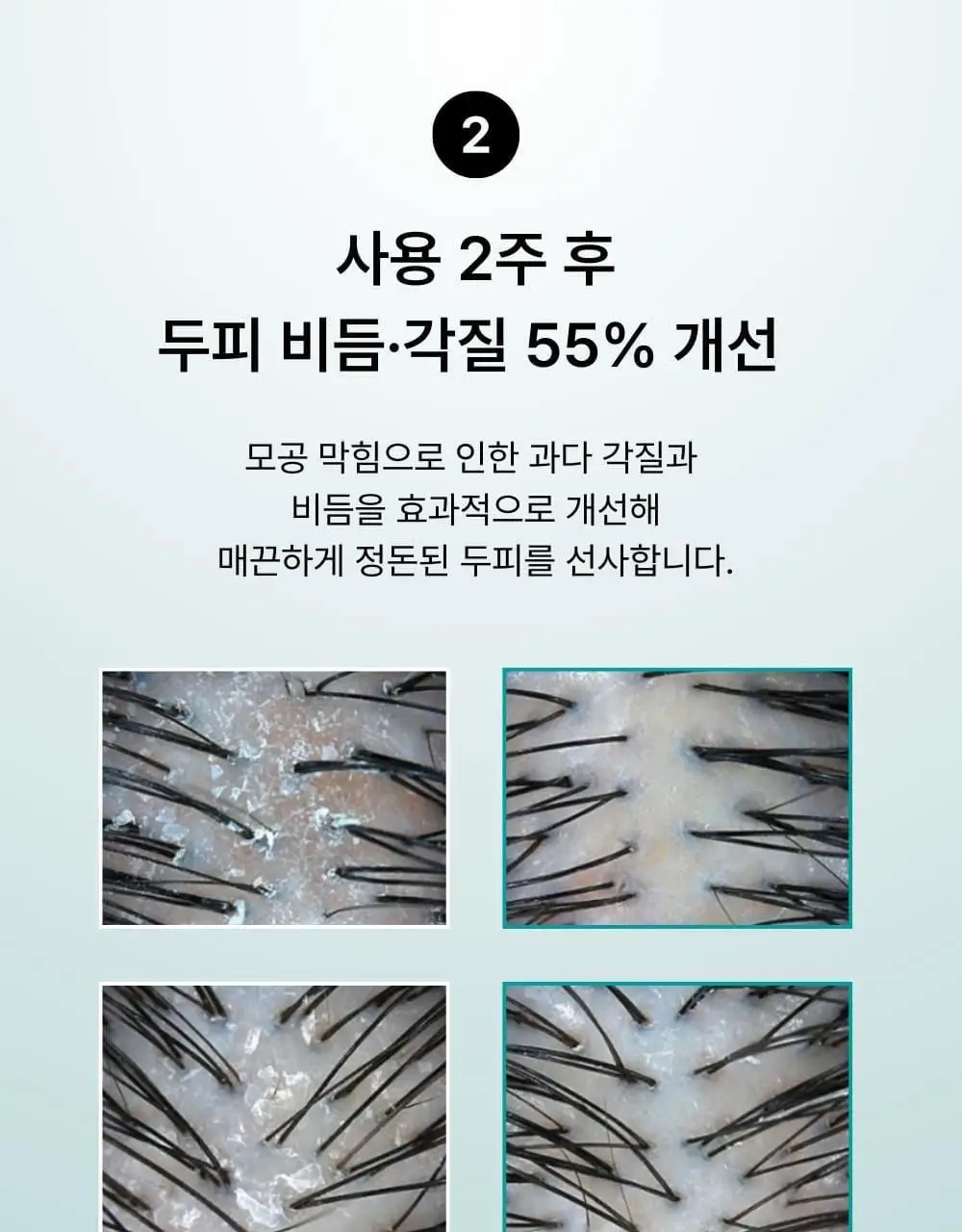 네쉬 민트 바이옴스칼프 딥클렌징 샴푸 250ml 상세페이지 7