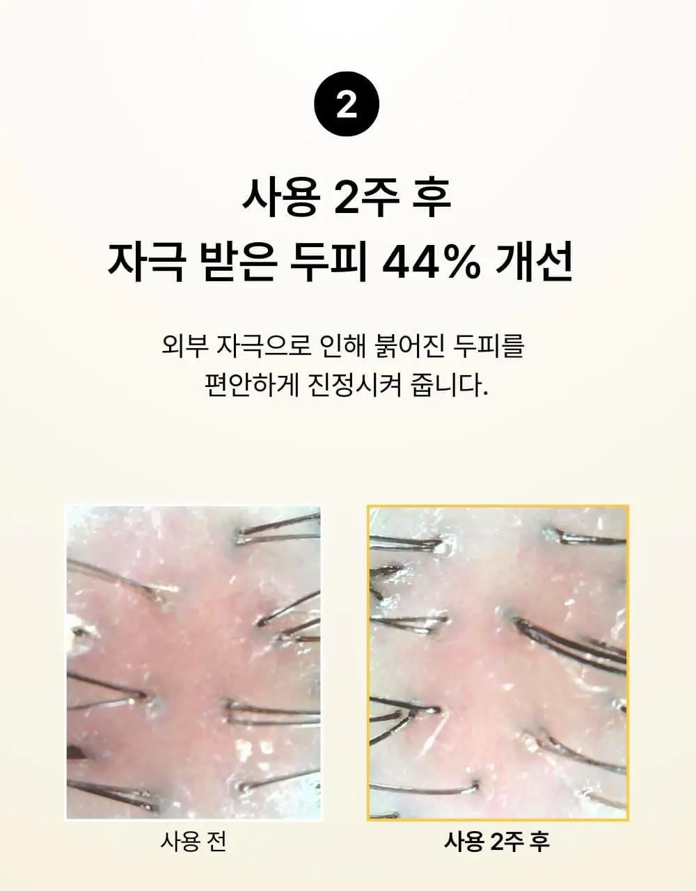 네쉬 소이 바이옴 스칼프 밸런싱 샴푸 480ml 상세페이지 7