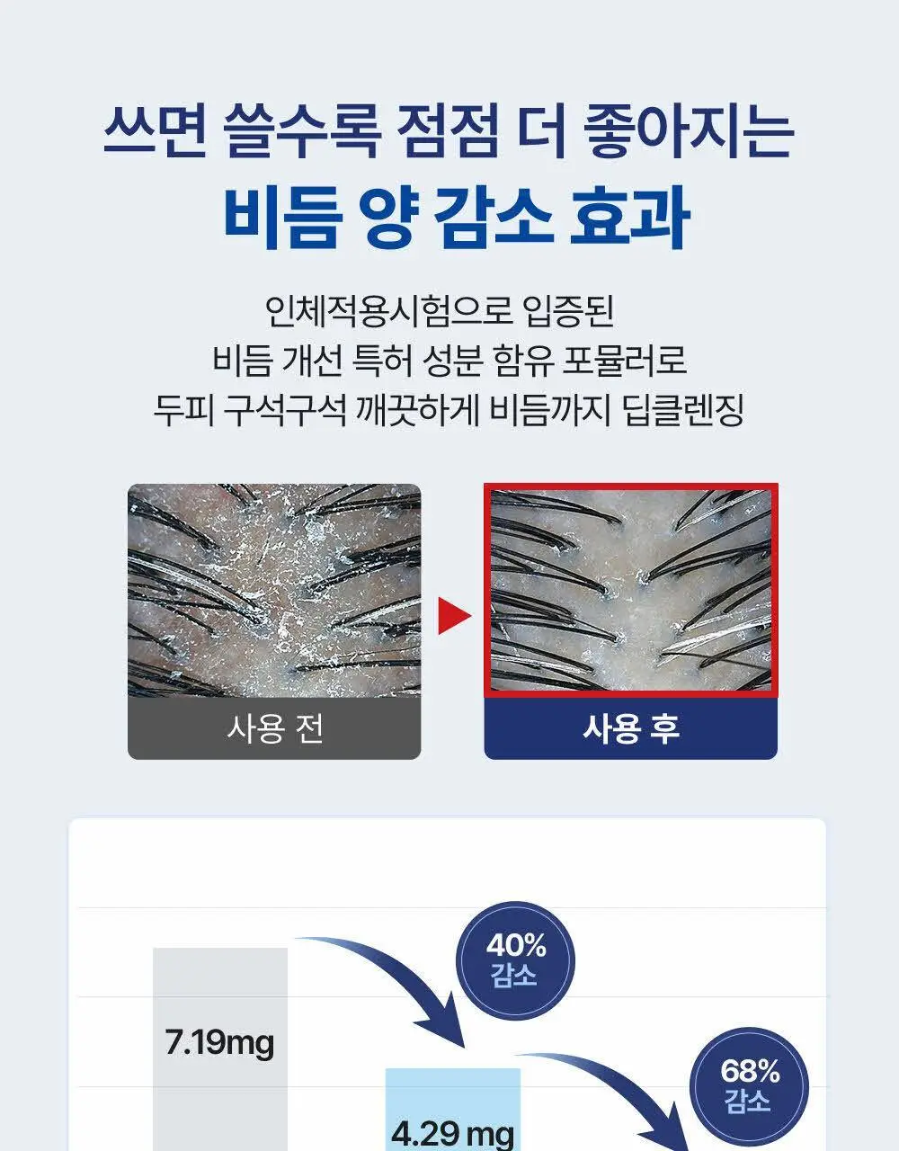 닥터그루트 스칼프솔루션 샴푸 700ml 4종택1 (쿨링샴푸) 상세페이지 13