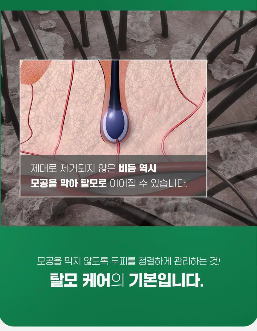 닥터방기원 댄드러프 비듬탈모샴푸 1000ml 더블세트 상세페이지 11