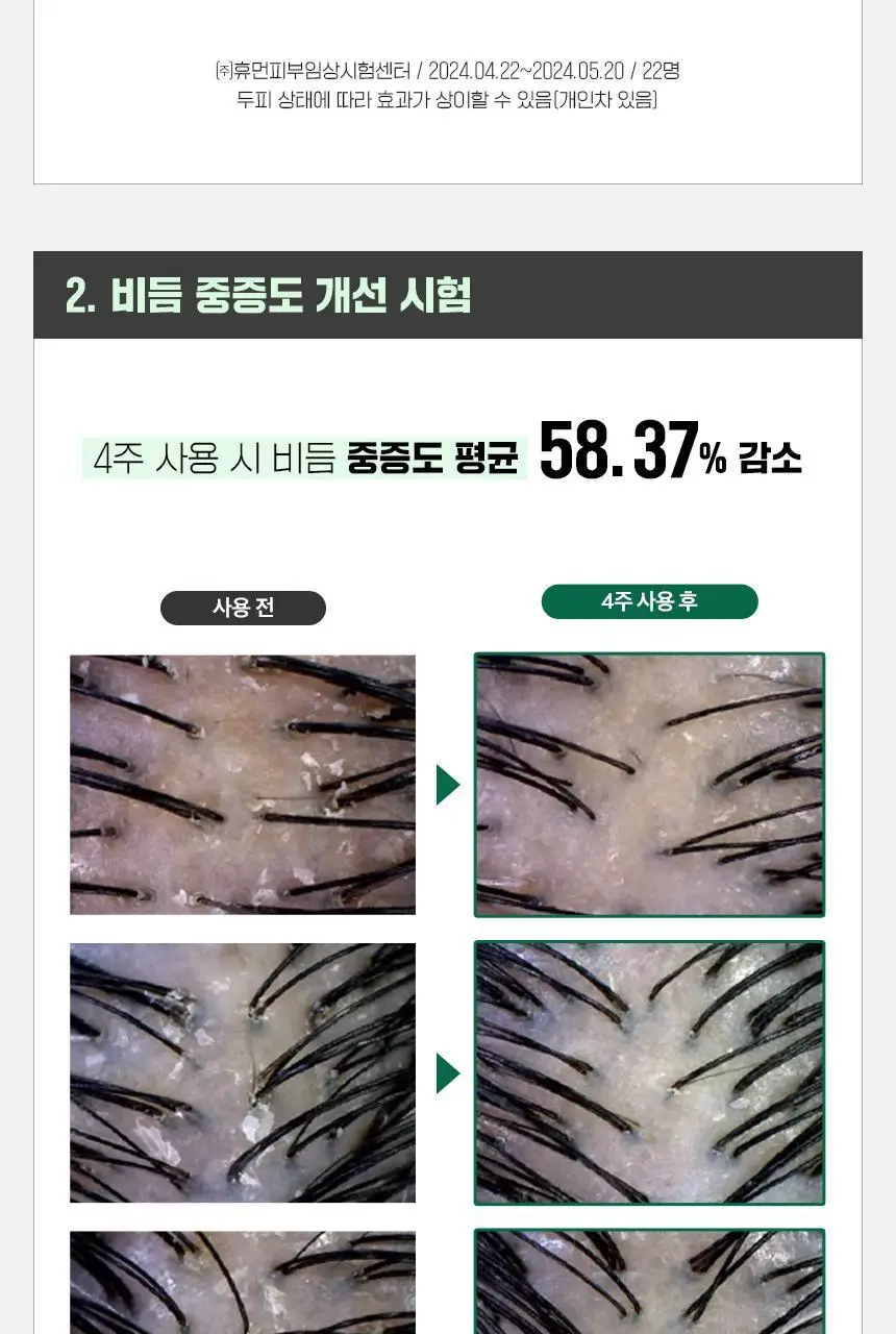 닥터방기원 댄드러프 비듬탈모샴푸 1000ml 더블세트 상세페이지 13