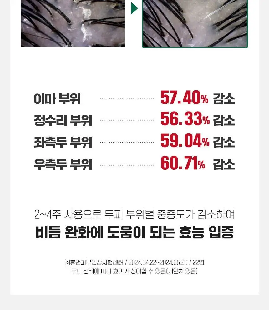 닥터방기원 댄드러프 비듬탈모샴푸 1000ml 더블세트 상세페이지 14