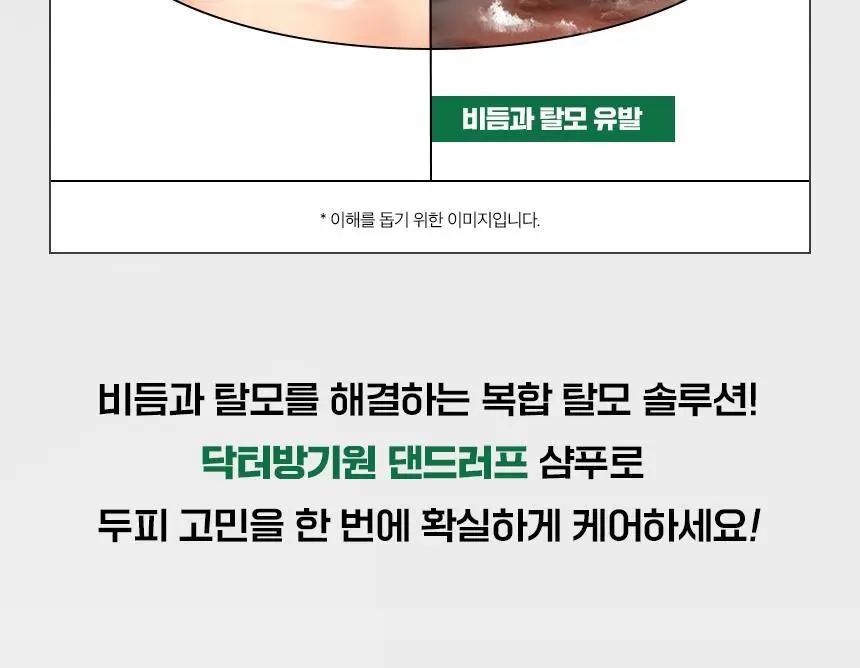 닥터방기원 댄드러프 비듬탈모샴푸 1000ml 더블세트 상세페이지 22